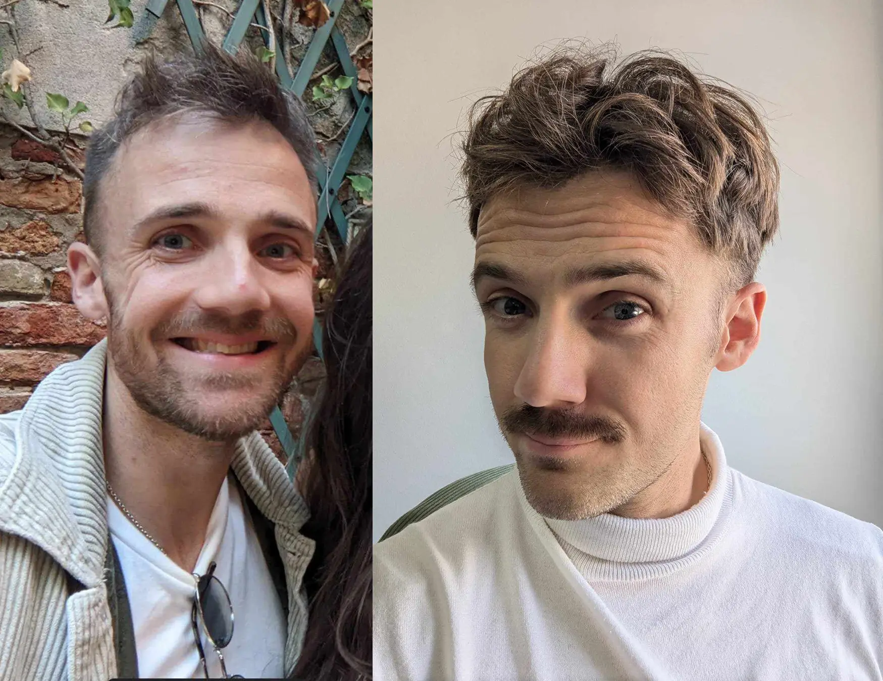 Before / After 10