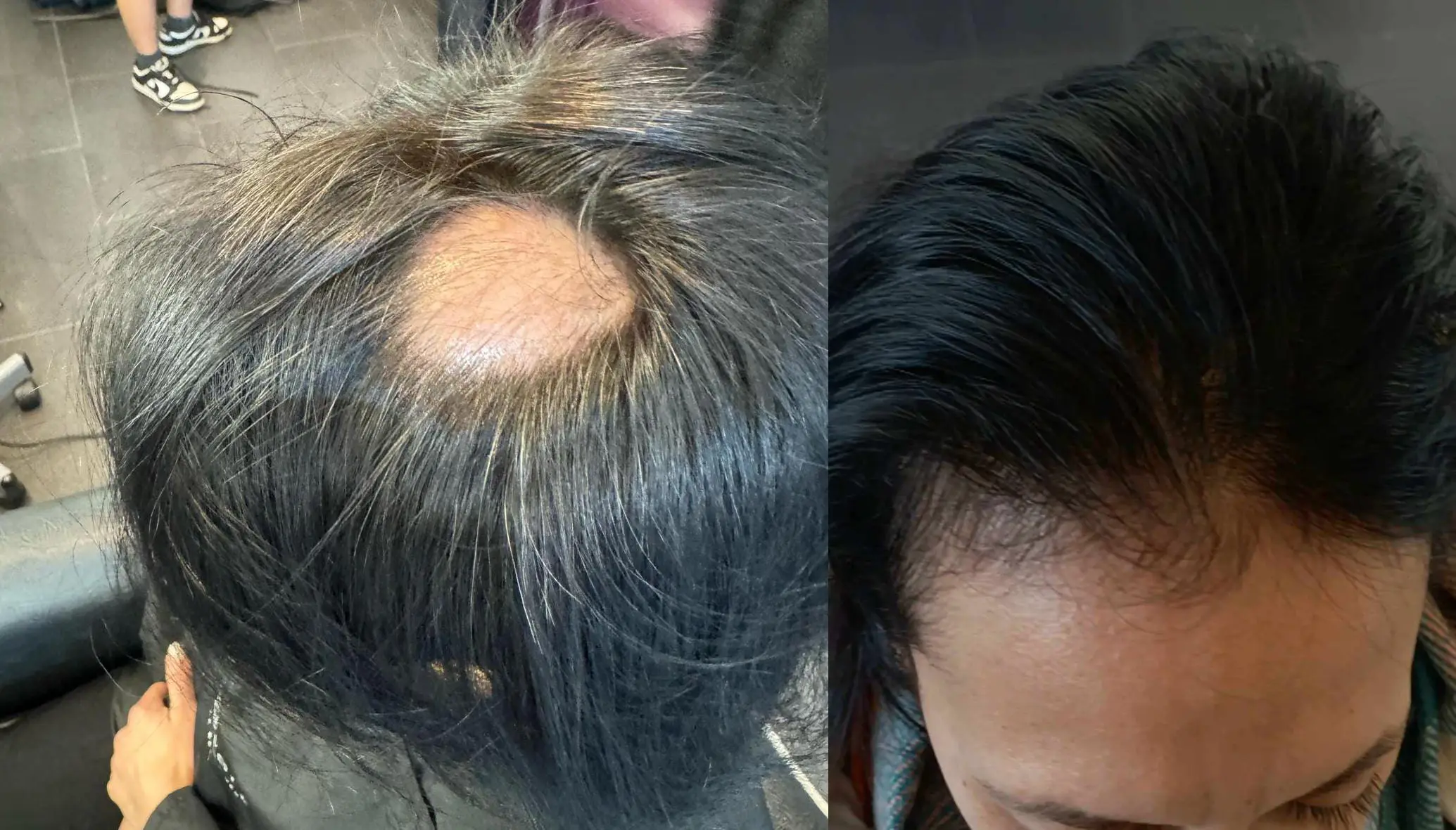 Before / After 12
