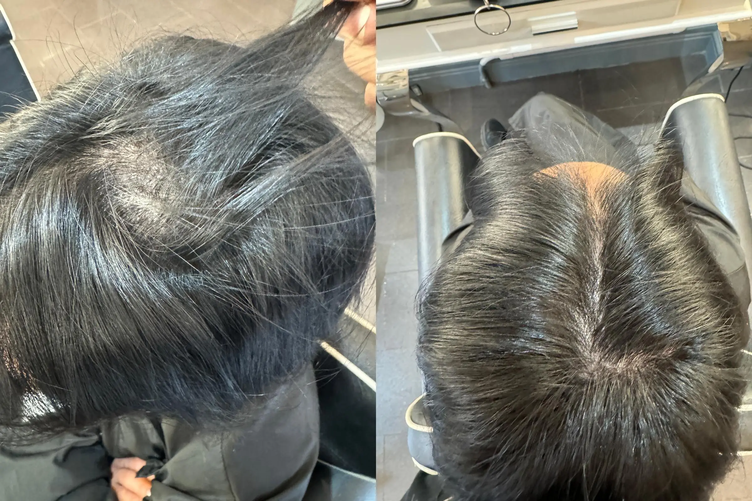Before / After 4
