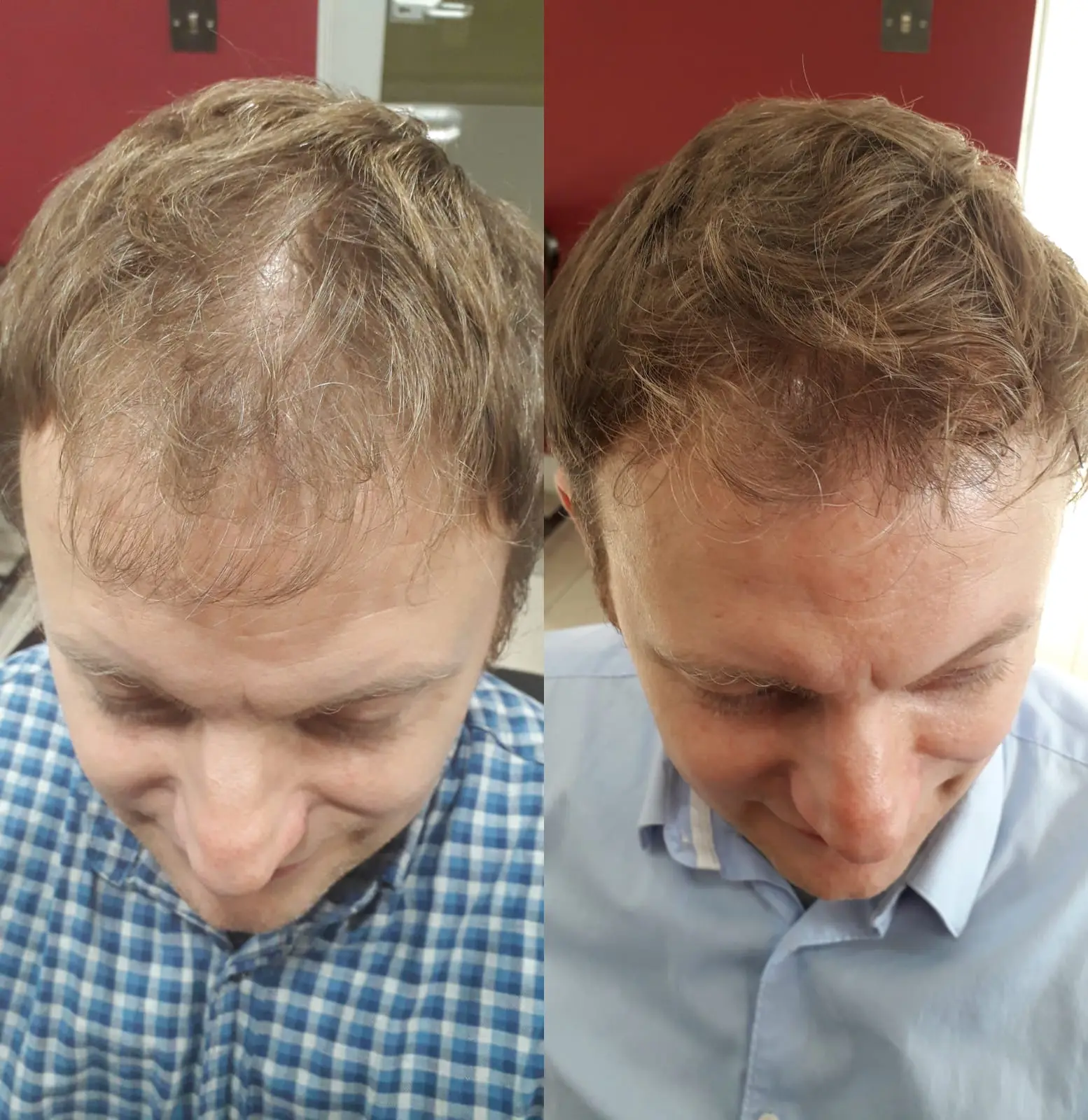 Before / After 5