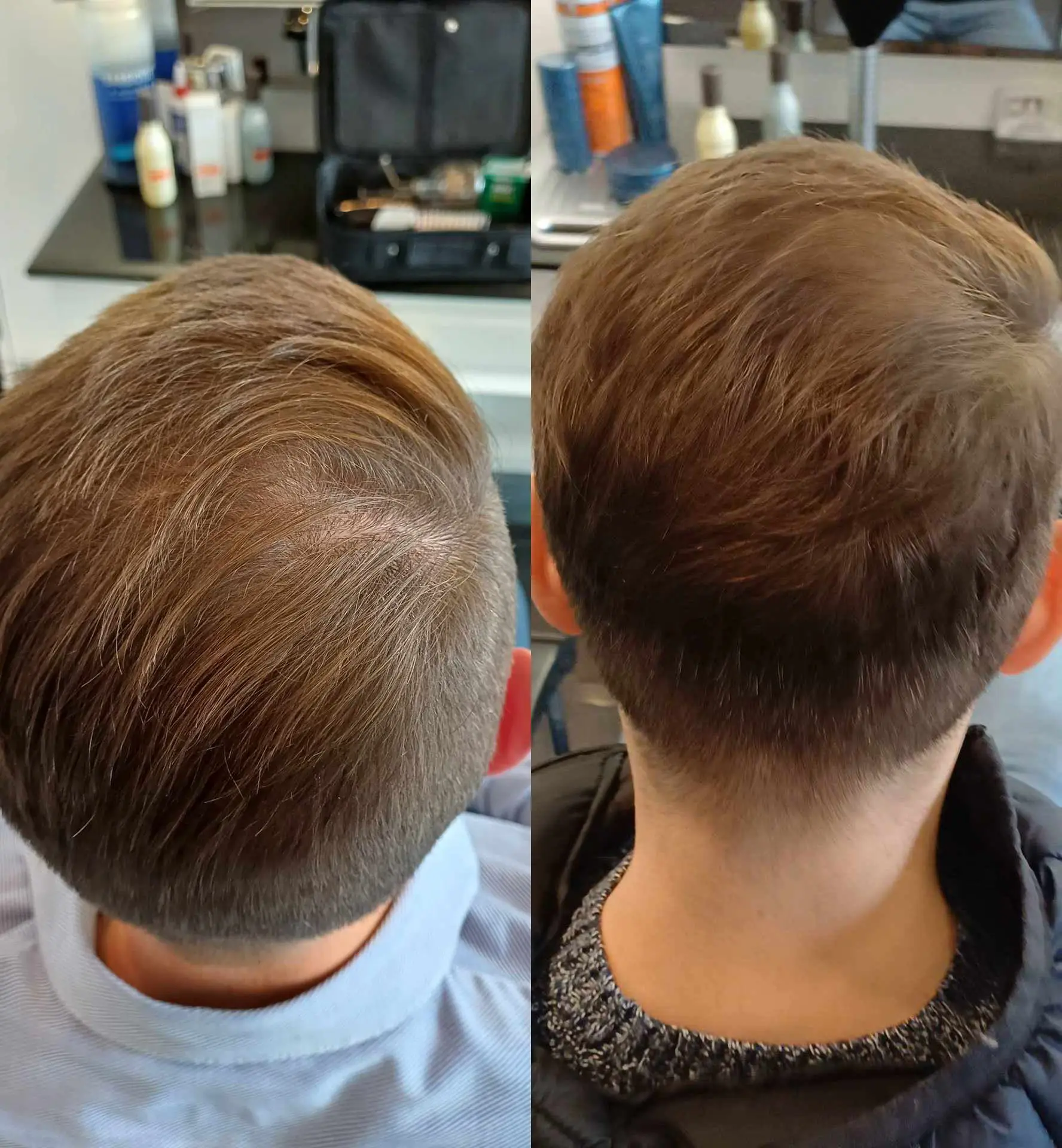 Before / After 7